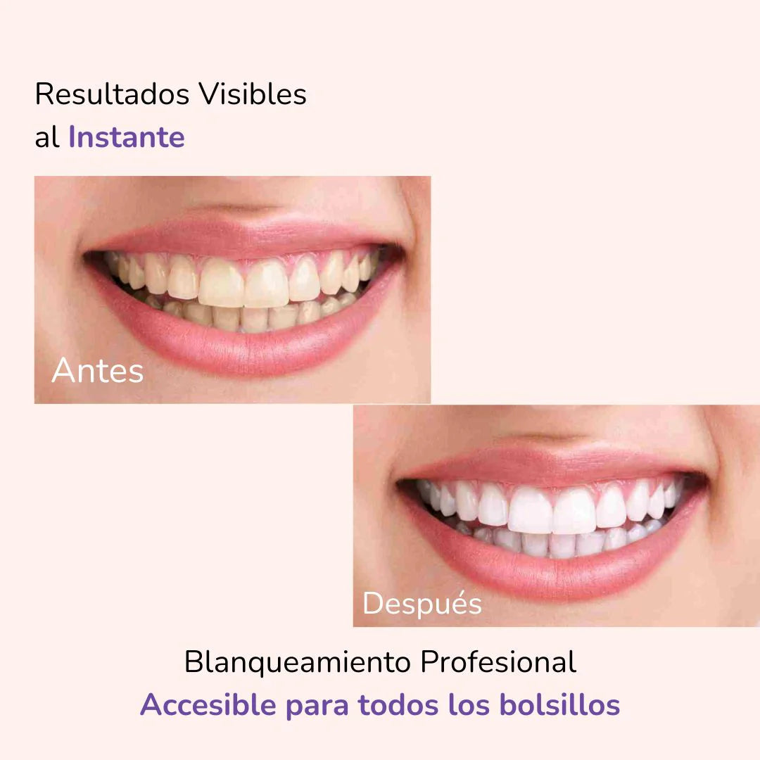 Blanqueador Purple Brunellie v34® | Edición Limitada