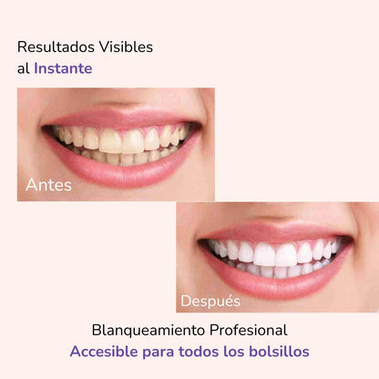 Blanqueador Purple Brunellie v34® | Edición Limitada