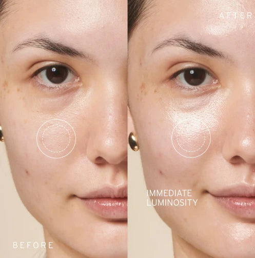 Brunellie™ –  Parches Skincare Coreano (Edición Limitada)