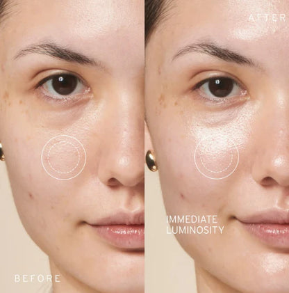 Brunellie™ –  Parches Skincare Coreano (Edición Limitada)