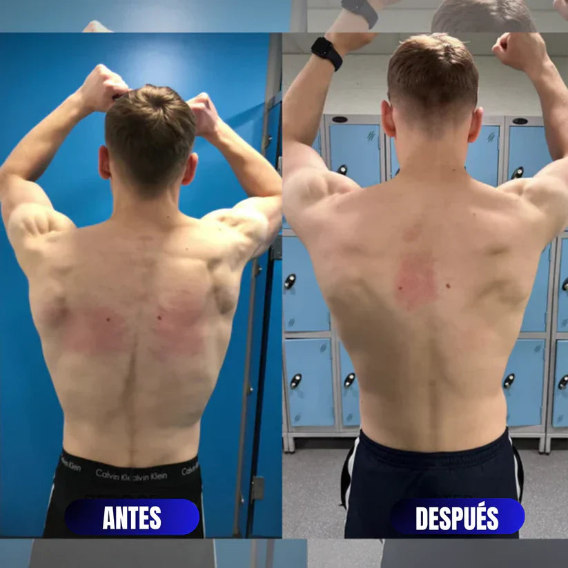 Corrector de Espalda (Edición Limitada)