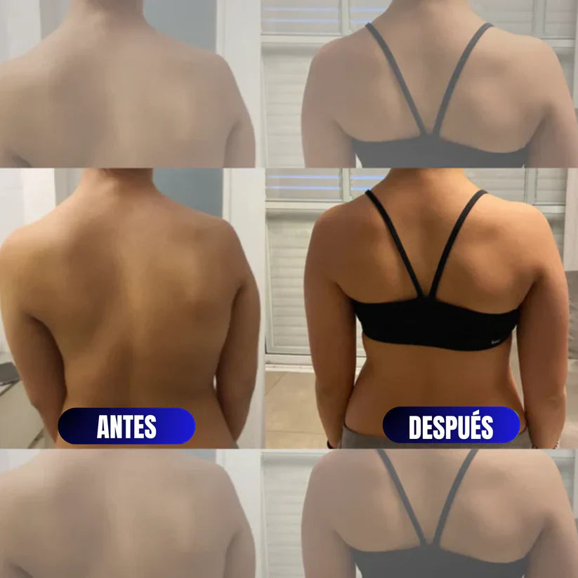 Corrector de Espalda (Edición Limitada)